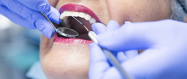 Best Broken or Chipped Tooth Repair in Unionville, MO